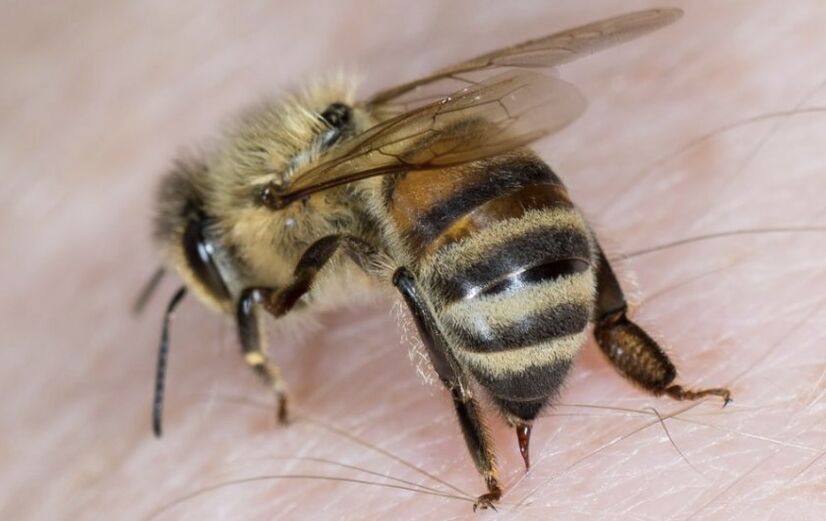 蜜蜂蜇伤阴茎增大