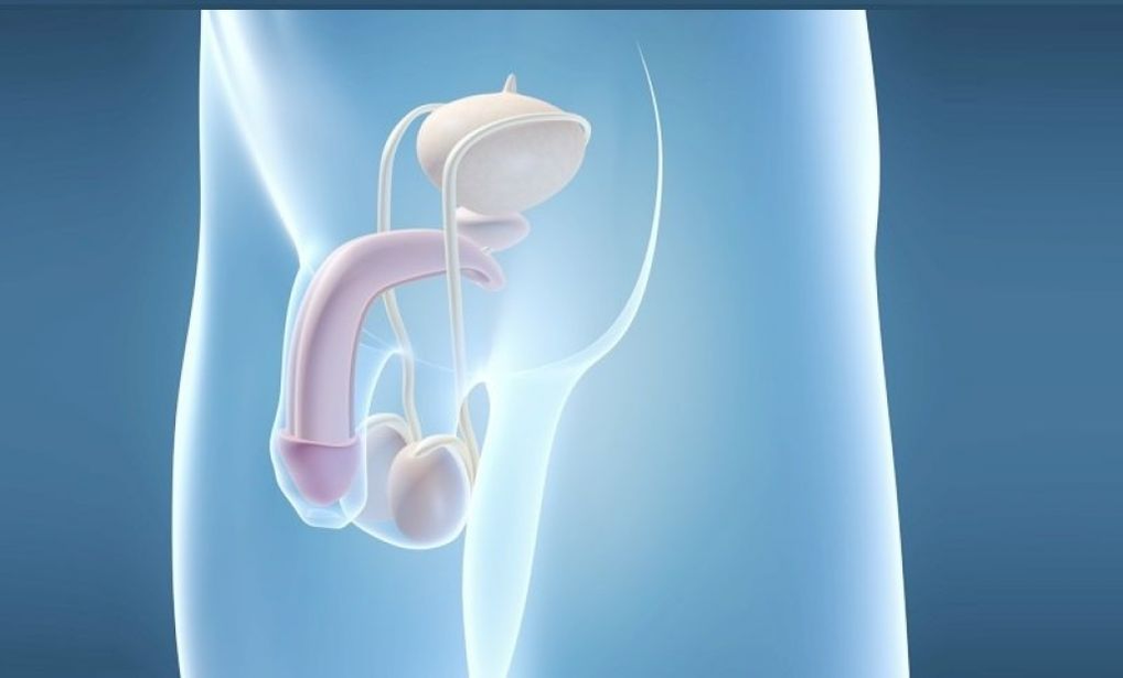 假体植入术是一种增大男性阴茎的手术方法